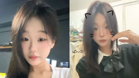 张佳宁