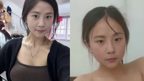 张蕊