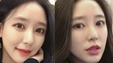 张慧雯
