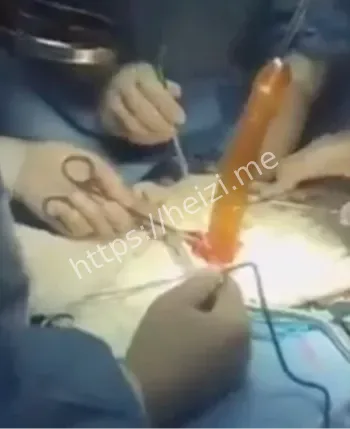 暴力虐待