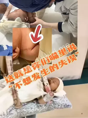 医院打人