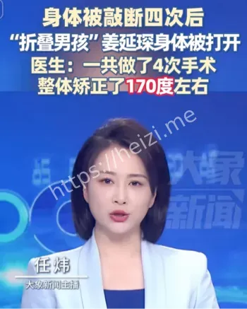 先天性肌肉病
