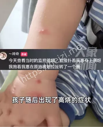 卫生