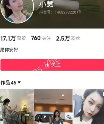 小慧
