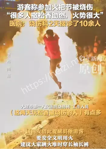 烧伤科接诊