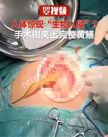 急诊科