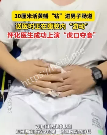 猎奇事件
