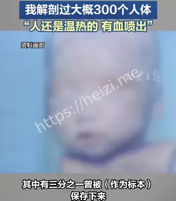 口述证言