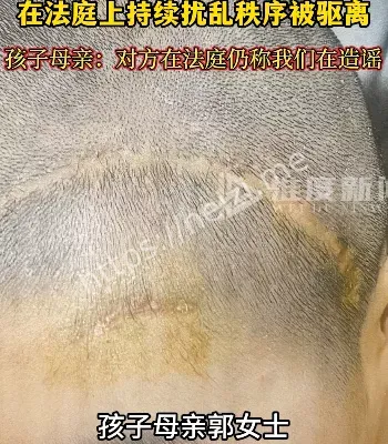 故意伤害
