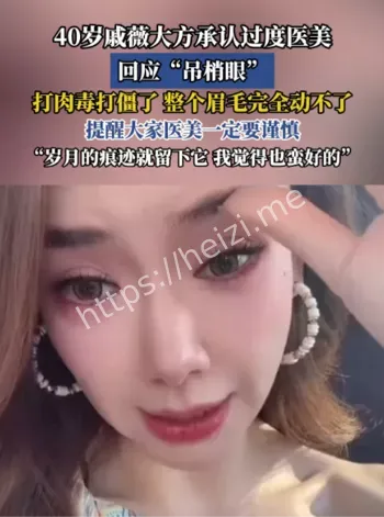 戚薇