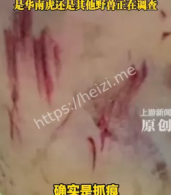 老虎伤人事件