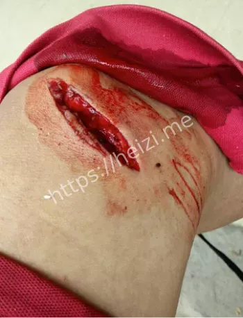 血腥