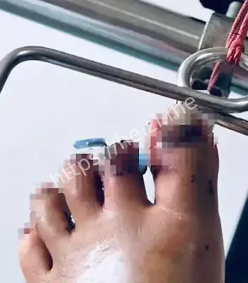 驴友遇险