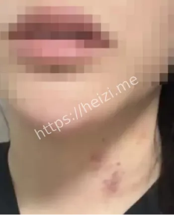 衡阳事件