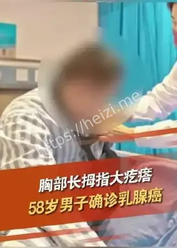 乳腺癌