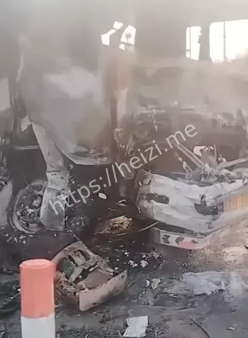 司机烧成火人