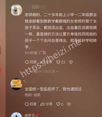 女童耳廓撕裂