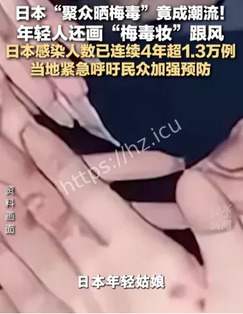 日本梅毒感染