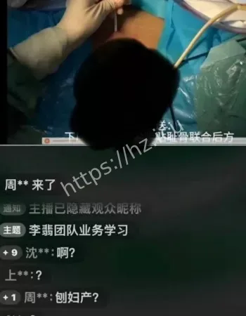 女子隐私部位