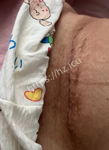 明知身患艾滋