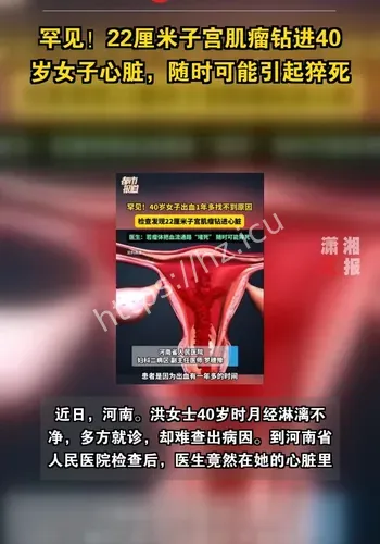 传播路径观察