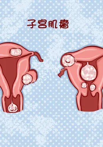 后续进展关注